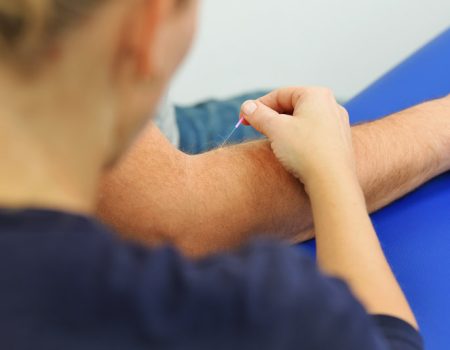 BAS_4174-Dry_Needling-2-800x600px